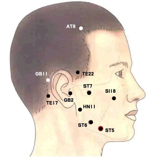 hn11 c