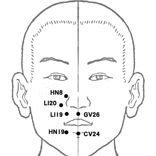 li20